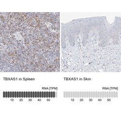 Thromboxane synthase Antibody, Novus Biologicals 25 &mu;L, Unlabeled:Antibodies,